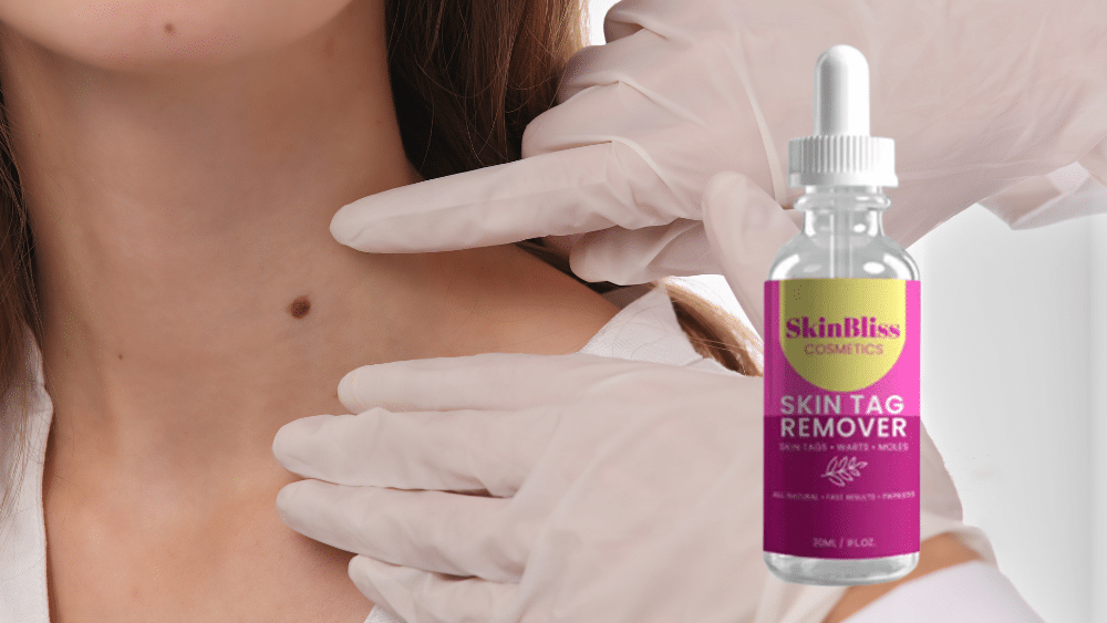 Skinbliss im Test