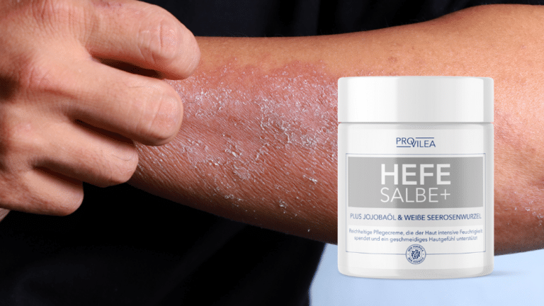 Hefesalbe im Test